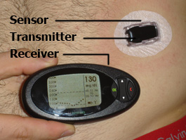 Dexcom 7